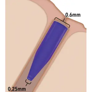 Punctum plug Soft ED 180-T 40pk ONE SIZE 6210